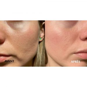 ARTIQUE Masque Visage Energisant BOOSTER _ 25 ml x 5 (5)