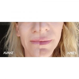 Masque Anti‑Âge Régénérant _ 25 ml x 5 (5)