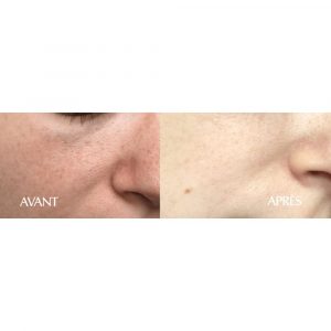 Masque Visage Purifiant (5)